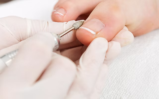 Dépose pieds